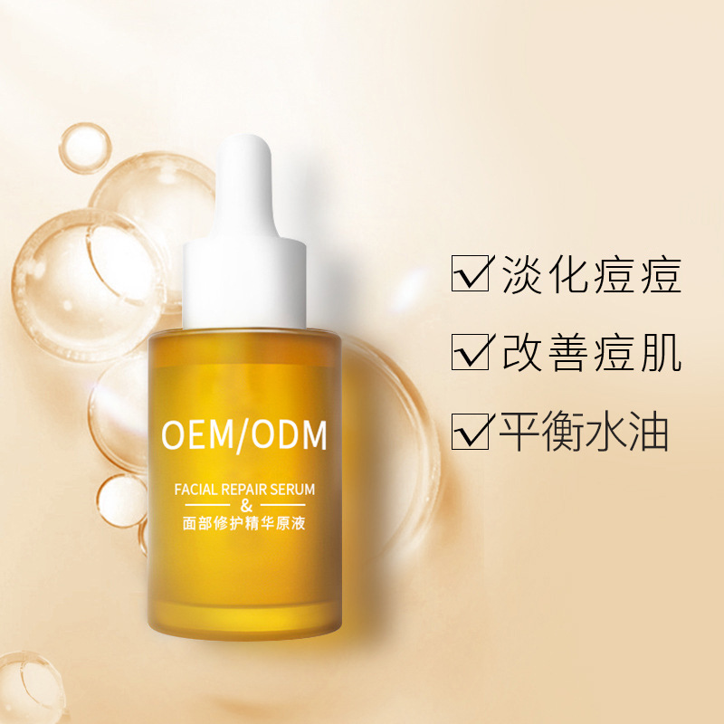 广东壹美制造_祛痘精华原液OEM