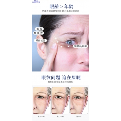 广东壹美制造_美容院玻尿酸微针眼贴